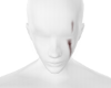 Face Scar