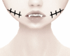 black mouth stitches