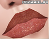 *MD*Rosa Jelly Lips|1