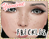 [Y] Anyskin Freckles III