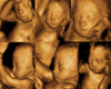 Ultrasound 4D Pictures