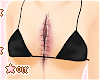 big scar