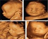 Ultrasound Collage