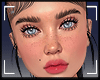 Migle MH