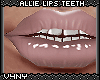 V4NY|Allie Lips Teeth7