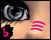 [B] *pink nose staples
