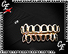 CE' Open Face Grillz