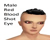 Red Blood Shot Eye