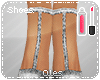 A|Heel-Less Heels|G.Silv