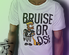 $' Bruise Or Lose