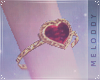 M~ Custom VDAY BraceR