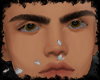 Skin tbn