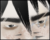 black eyes