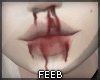⧮ Bloody Nose ⧯