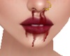 Nosebleed