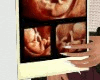 [HD] Ultrasound Collage