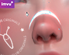 NHC - Crescent Septum F