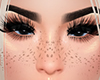🎀  HD Freckles