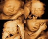 Ultrasound Collage