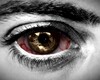 *D* Infected Brown