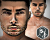 Everton Skin - HD