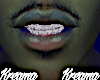 Custom | Mesh Grill