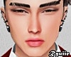 Zhao MH T1