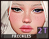 Lu-Sunkiss Freckles