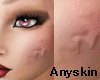 Anyskin blush ANI gears