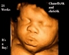 Custom HH Ultrasound Pic