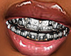 F| Metallic Grillz