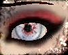 Bloodshot eyes