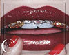 ck. $$ Gold Grillz