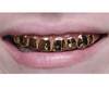 FEMALE GOLD GRILL