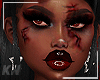 T6 | Bloody Skin 🩸