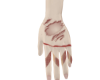 Hand Scar