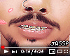 !J. Colorful Grillz