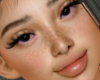 Freckles MH