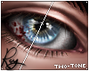            Blood Rupture
