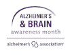 Alzheimers sign