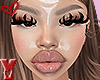 Ỿ | bo$$ (NL)