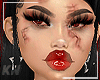 T0 | Bloody Skin 🩸