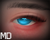 MD Starlight Eyes