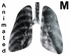 Faraday lungs ANI - M