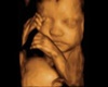 Kaylana's ultrasound