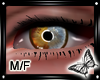 !! Heterochromia