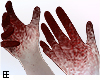 Blood Hands