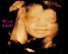 Custom HH Ultrasound Pic