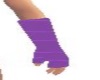 purple arm cast