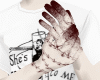 bloody hands + stitches
